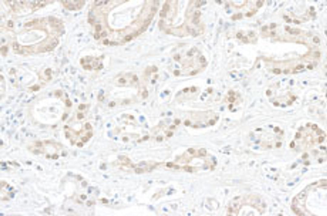 Detection of human BOP1 by immunohistochemistry.