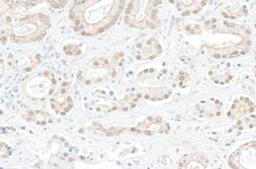 Detection of human BOP1 by immunohistochemistry.