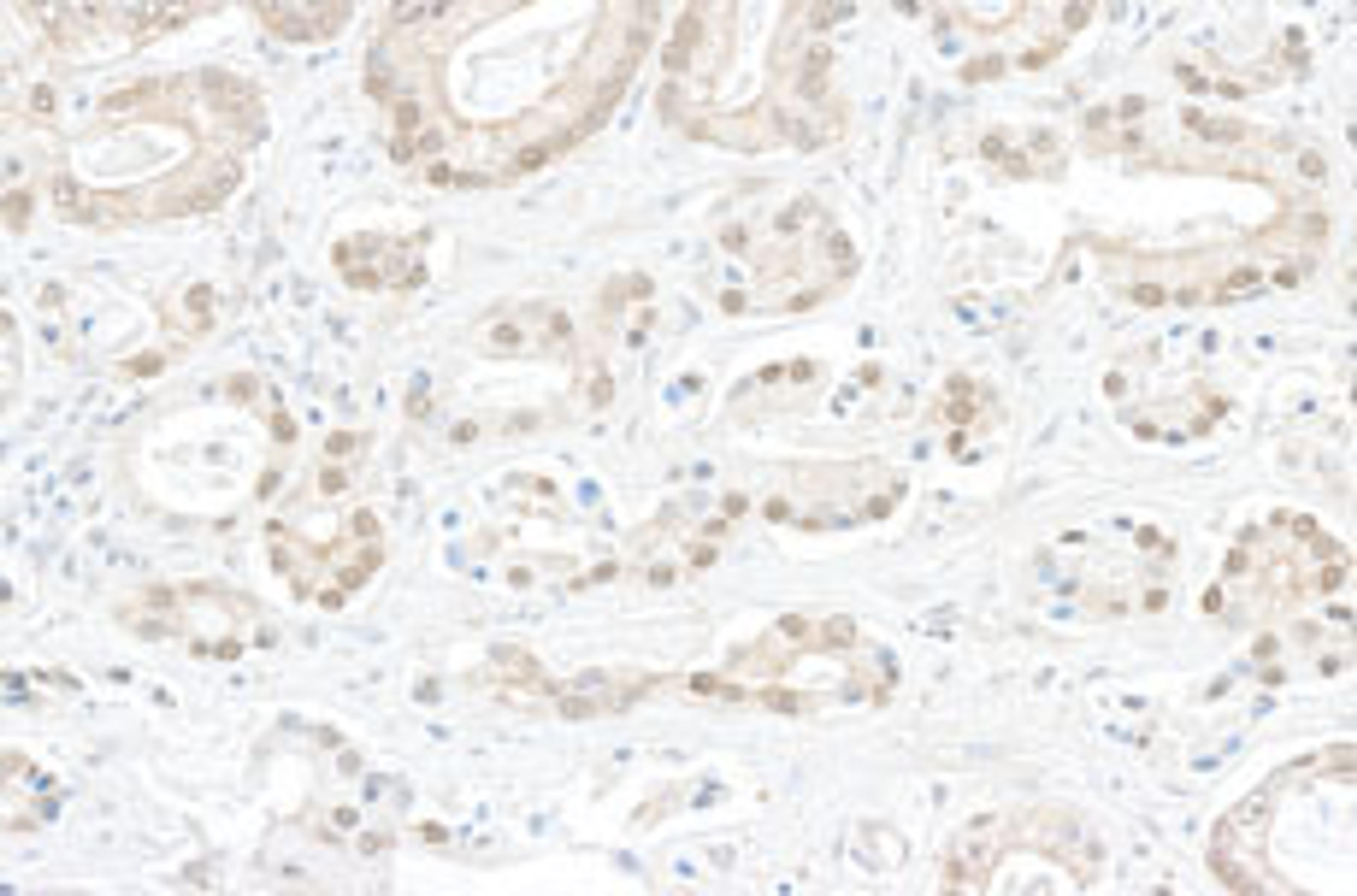 Detection of human BOP1 by immunohistochemistry.