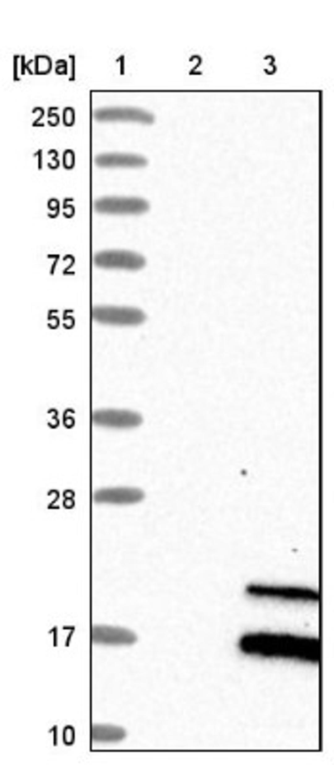 Western Blot: RNASE7 Antibody [NBP1-86134] - Lane 1: Marker [kDa] 250, 130, 95, 72, 55, 36, 28, 17, 10<br/>Lane 2: Negative control (vector only transfected HEK293T lysate)<br/>Lane 3: Over-expression lysate (Co-expressed with a C-terminal myc-DDK tag (~3.1 kDa) in mammalian HEK293T cells, LY410028)