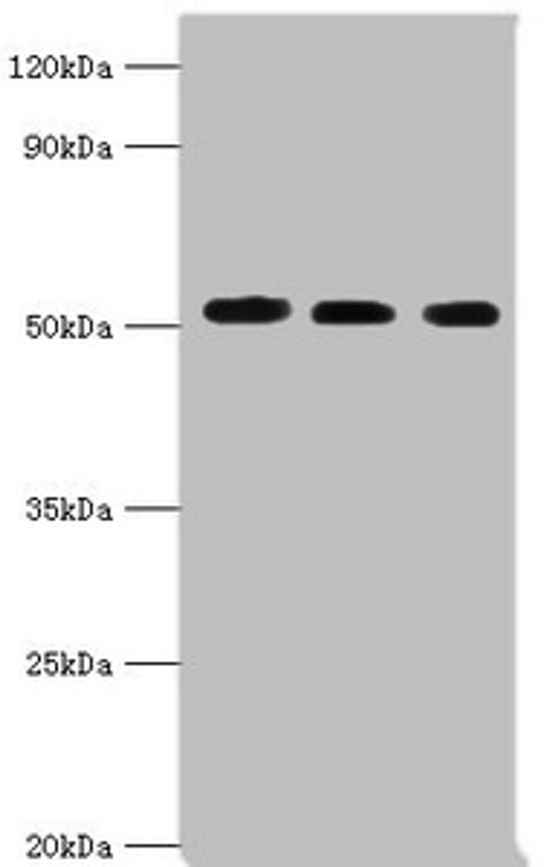 Western blot. All lanes: Programmed cell death protein 4 antibody at 5ug/ml. Lane 1: Hela whole cell lysate. Lane 2: MCF-7 whole cell lysate. Lane 3: Jurkat whole cell lysate. Secondary. Goat polyclonal to rabbit IgG at 1/10000 dilution. Predicted band size: 52, 51 kDa. Observed band size: 52 kDa.