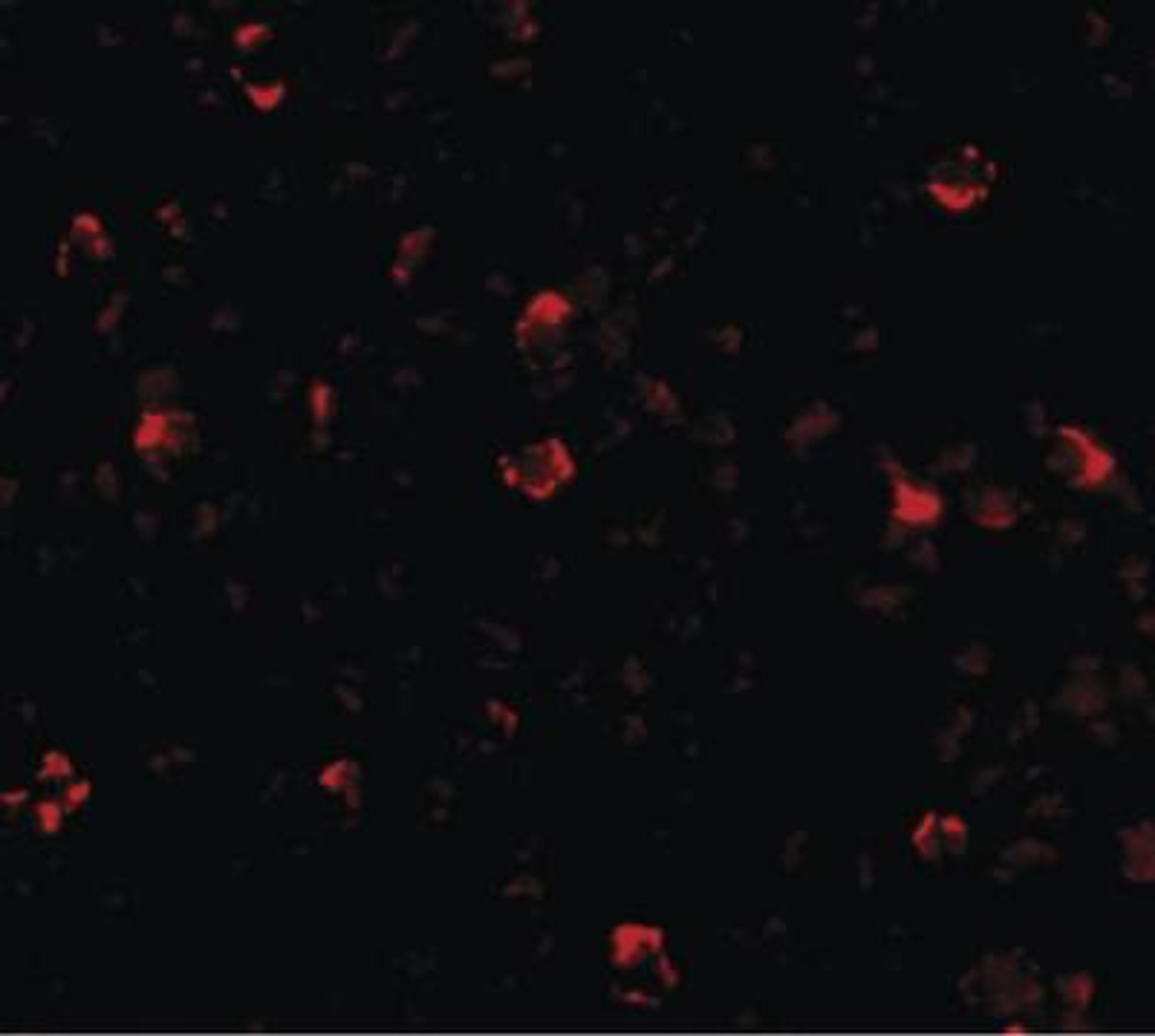 Immunofluorescence: IRGC Antibody [NBP1-72124] - Analysis in A20 cells at 20 ug/ml.