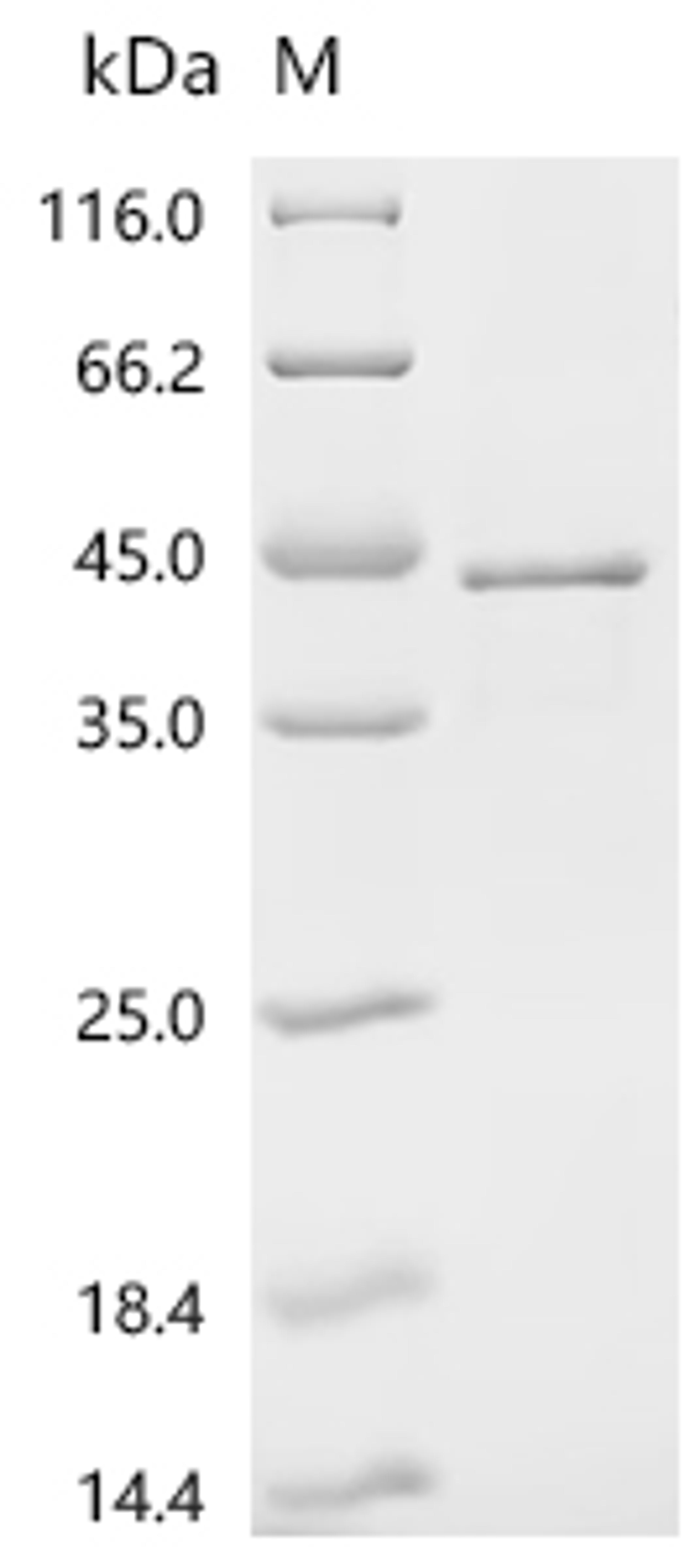 (Tris-Glycine gel) Discontinuous SDS-PAGE (reduced) with 5% enrichment gel and 15% separation gel.