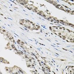 Immunohistochemical staining of mouse liver tissue using TCEB1 antibody