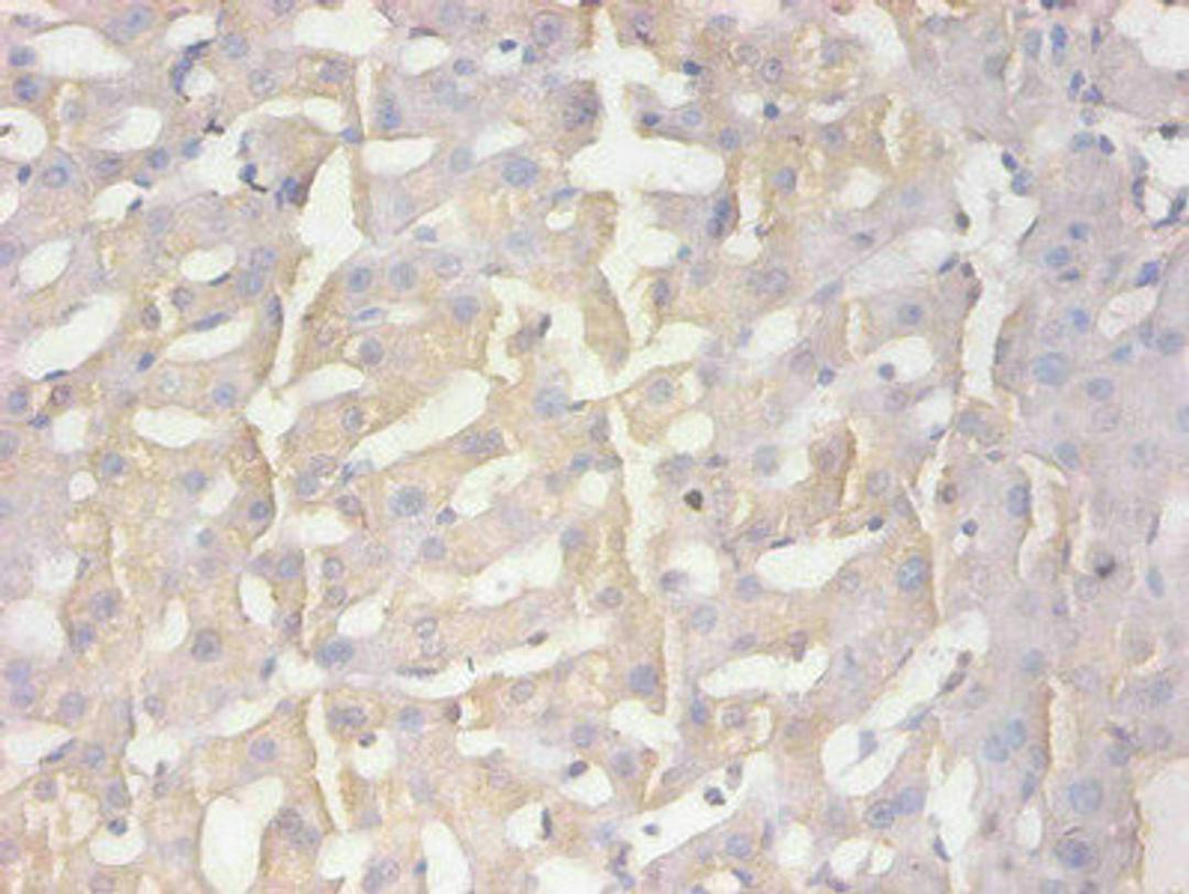Immunohistochemical of paraffin-embedded human liver tissue using CSB-MA100091A0m at dilution of 1:200  