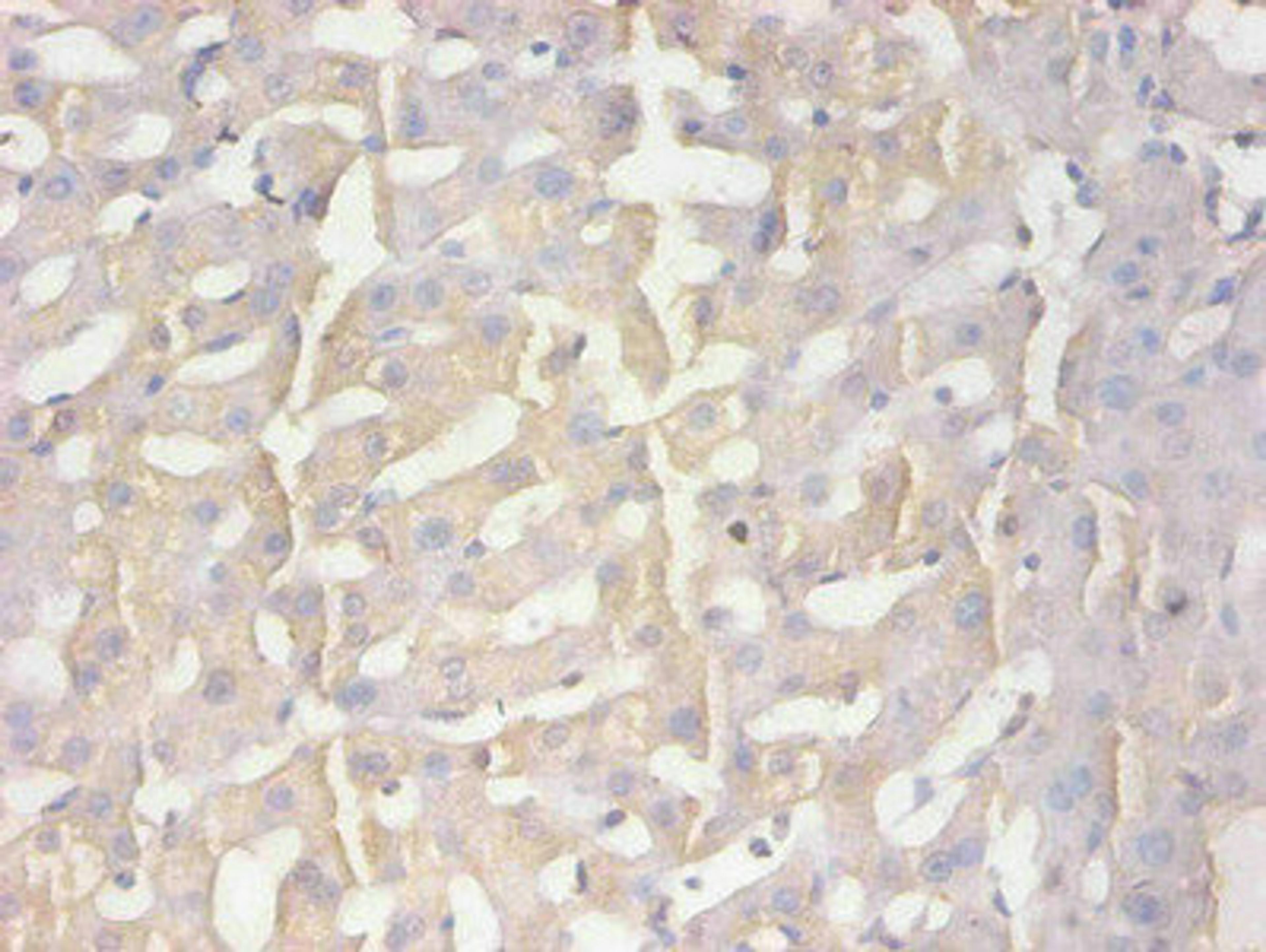 Immunohistochemical of paraffin-embedded human liver tissue using CSB-MA100091A0m at dilution of 1:200  