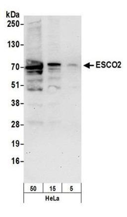 Detection of human ESCO2 by western blot.