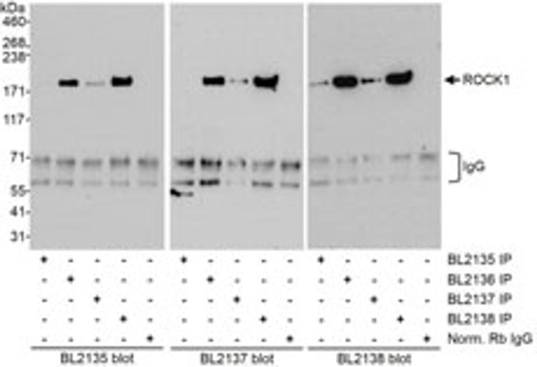 Detection of human ROCK1 by western blot of immunoprecipitates.