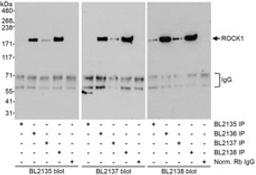 Detection of human ROCK1 by western blot of immunoprecipitates.