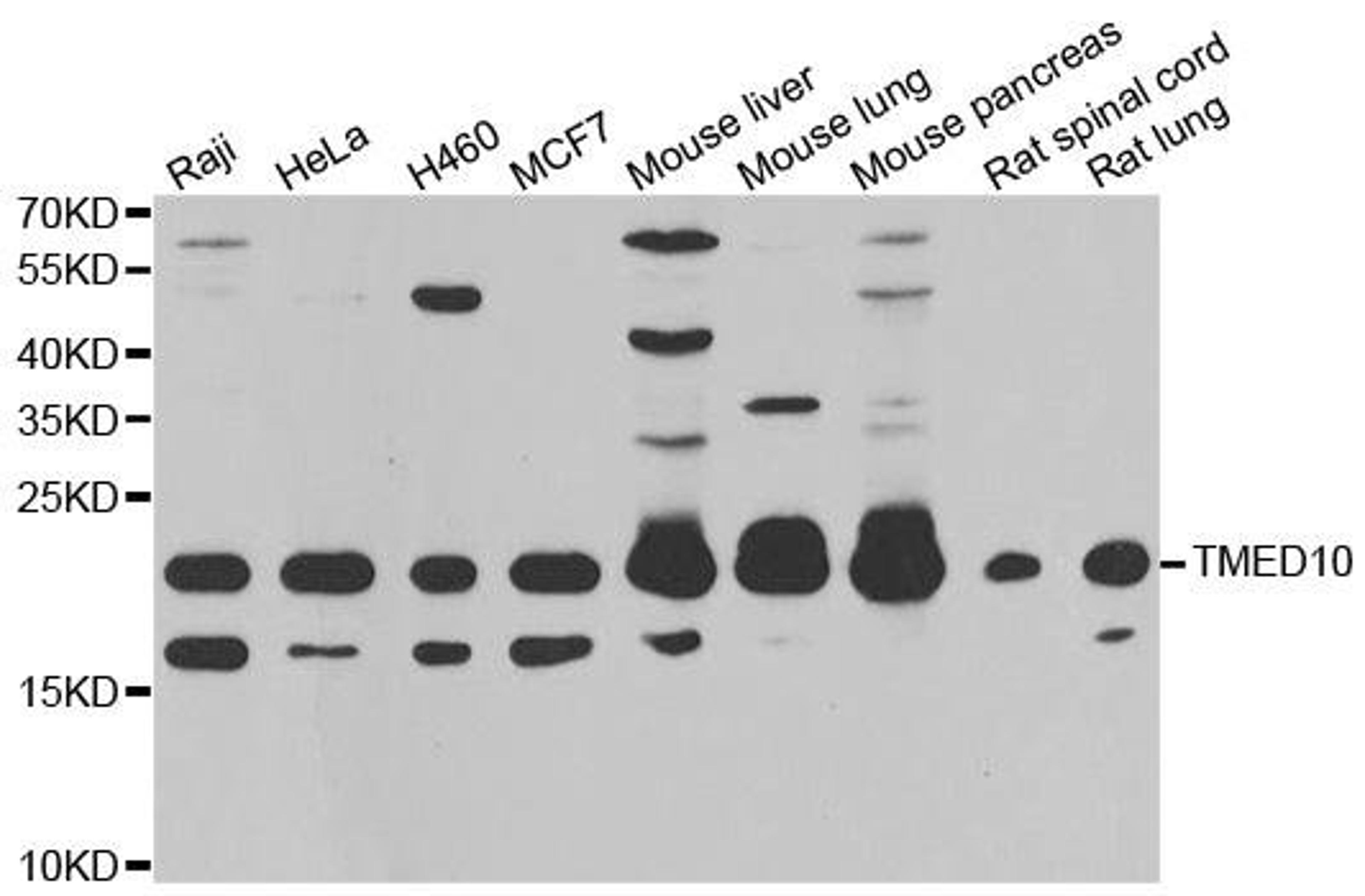 Western blot analysis of extracts of various cell lines using TMED10 antibody