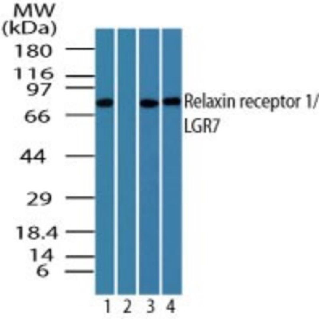 Western Blot: LGR7 Antibody [NBP2-24540] - Analysis of LGR7 in human heart lysate in the 1) absence and 2) presence of immunizing peptide, 3) mouse heart and 4) rat heart lysate using LGR7 antibody at 0.5 ug/ml (human), 1 ug/ml (mouse) and 2 ug/ml (rat).