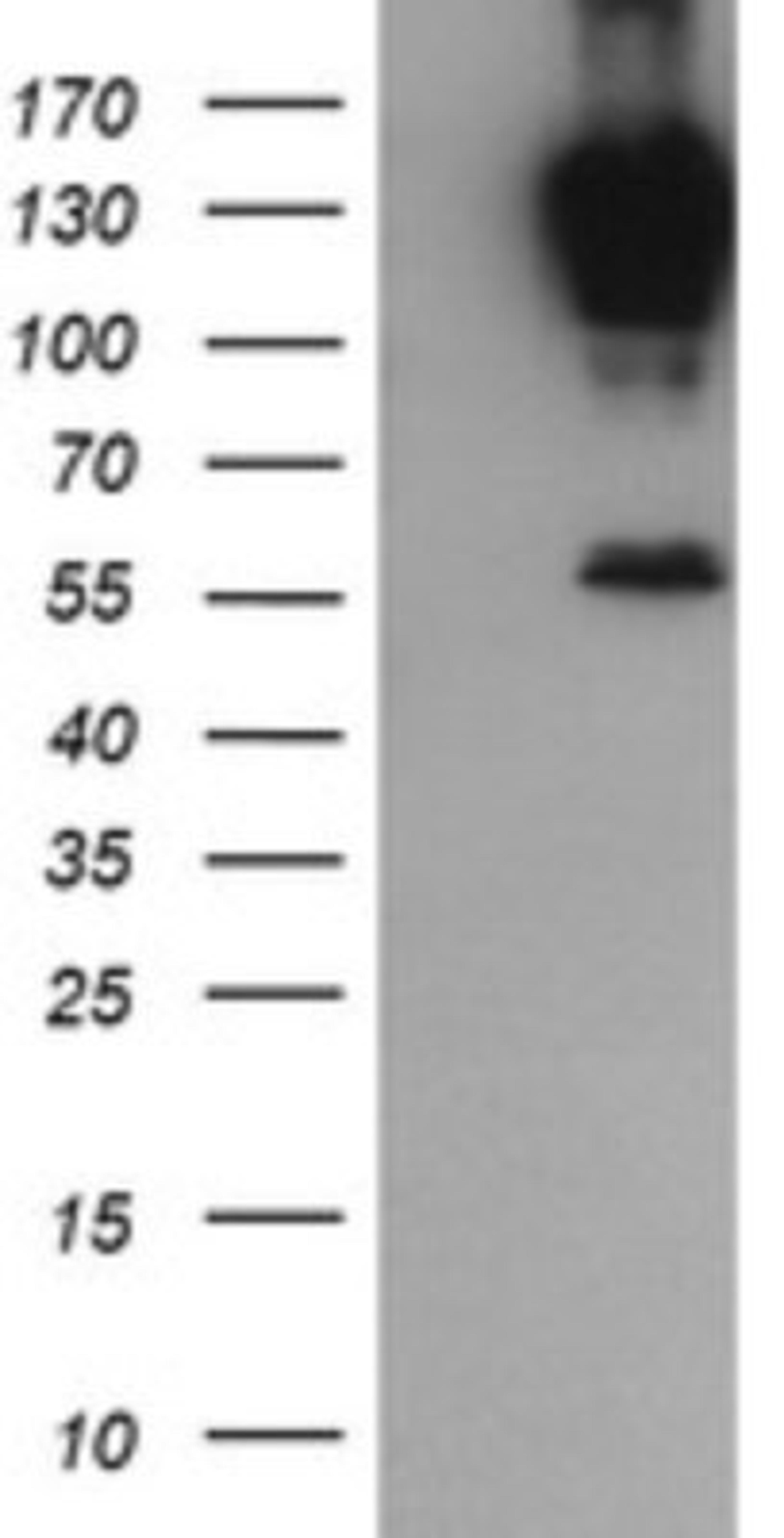 Western Blot: PCDH7 Antibody (1F7) [NBP2-46340] - Analysis of HEK293T cells were transfected with the pCMV6-ENTRY control (Left lane) or pCMV6-ENTRY PCDH7.