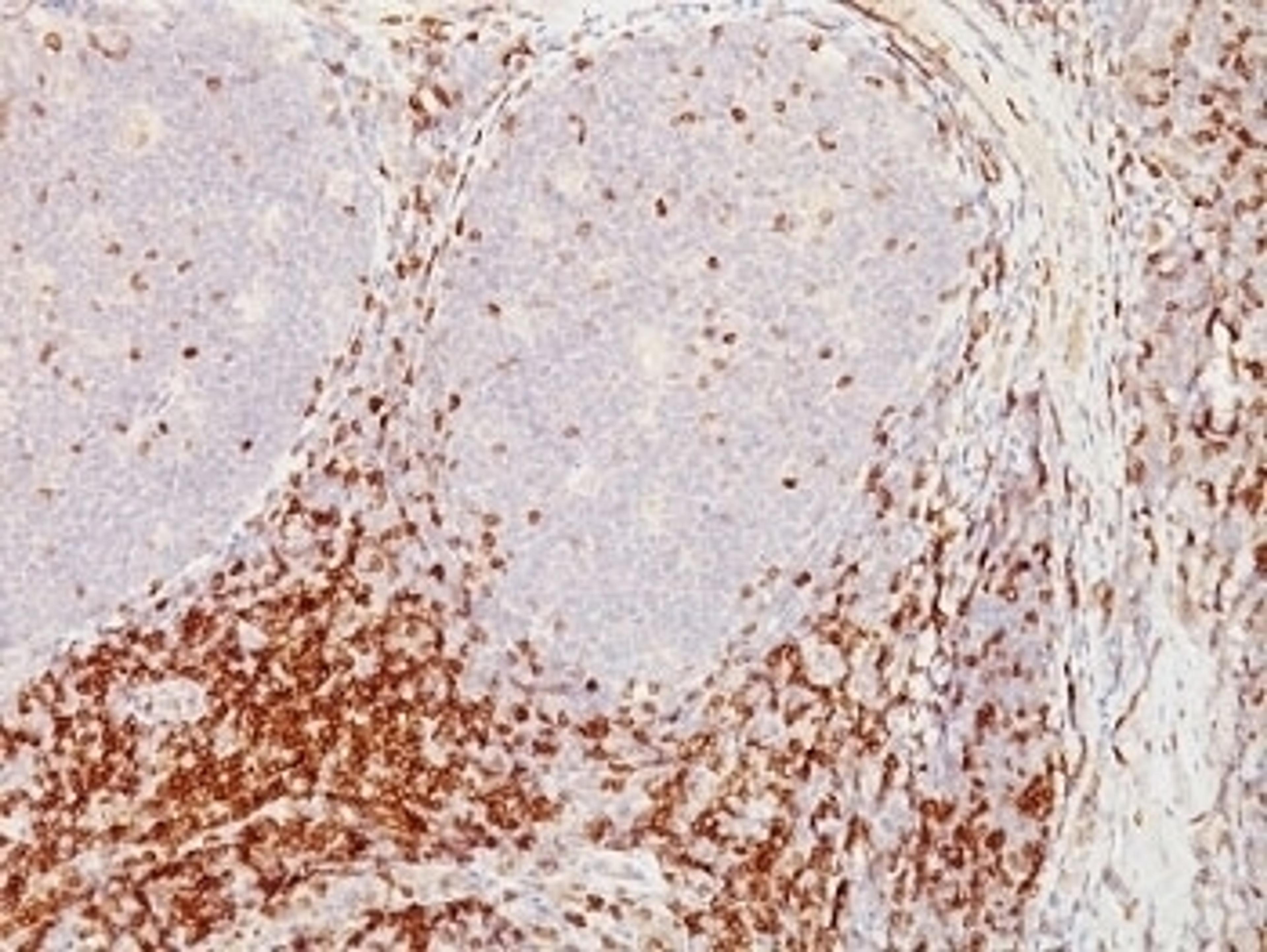 Formalin-fixed, paraffin-embedded human tonsil stained with CD5 antibody (CD5/54/F6)