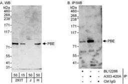 Detection of human PBE by western blot and immunoprecipitation.