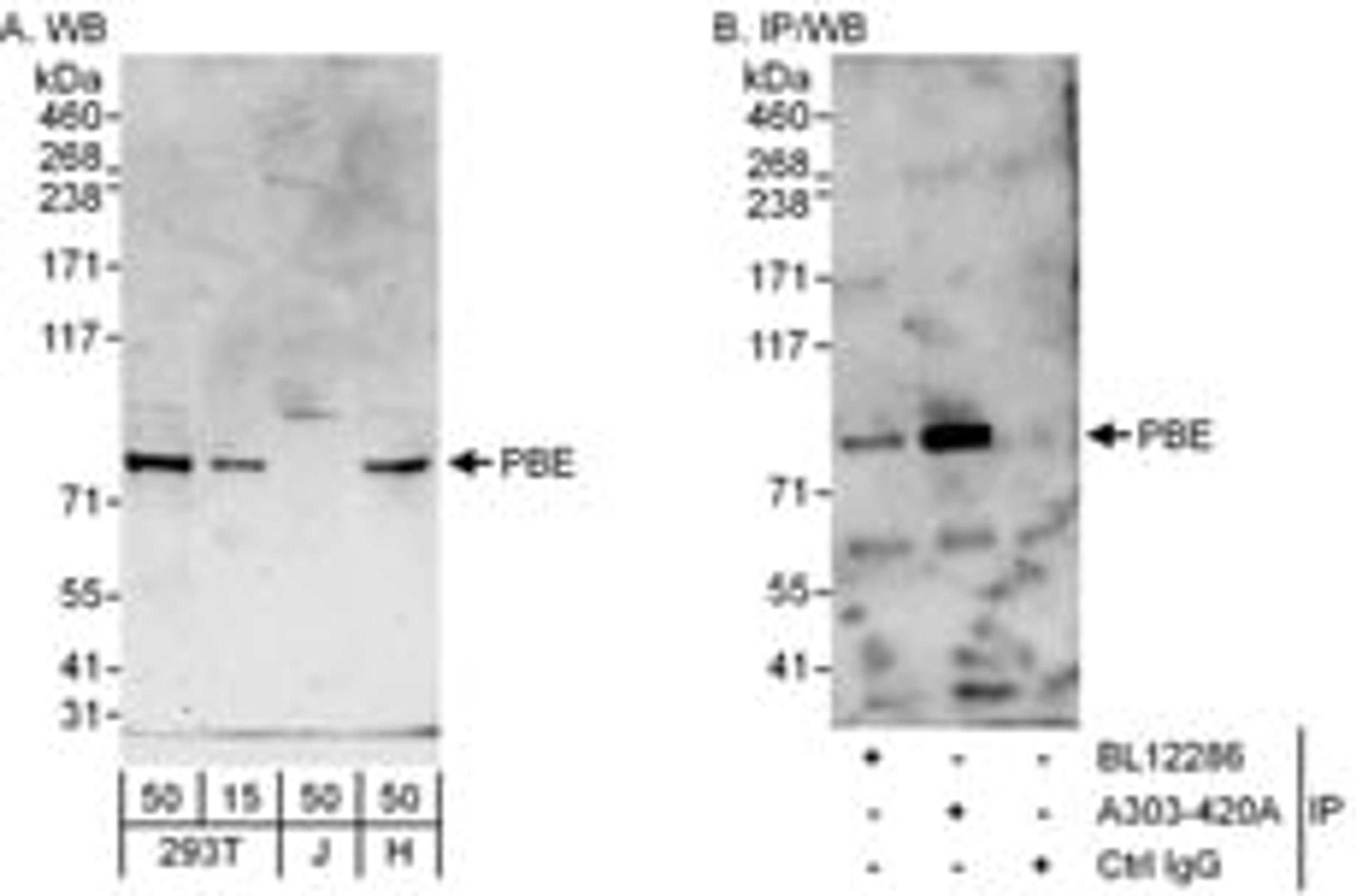 Detection of human PBE by western blot and immunoprecipitation.