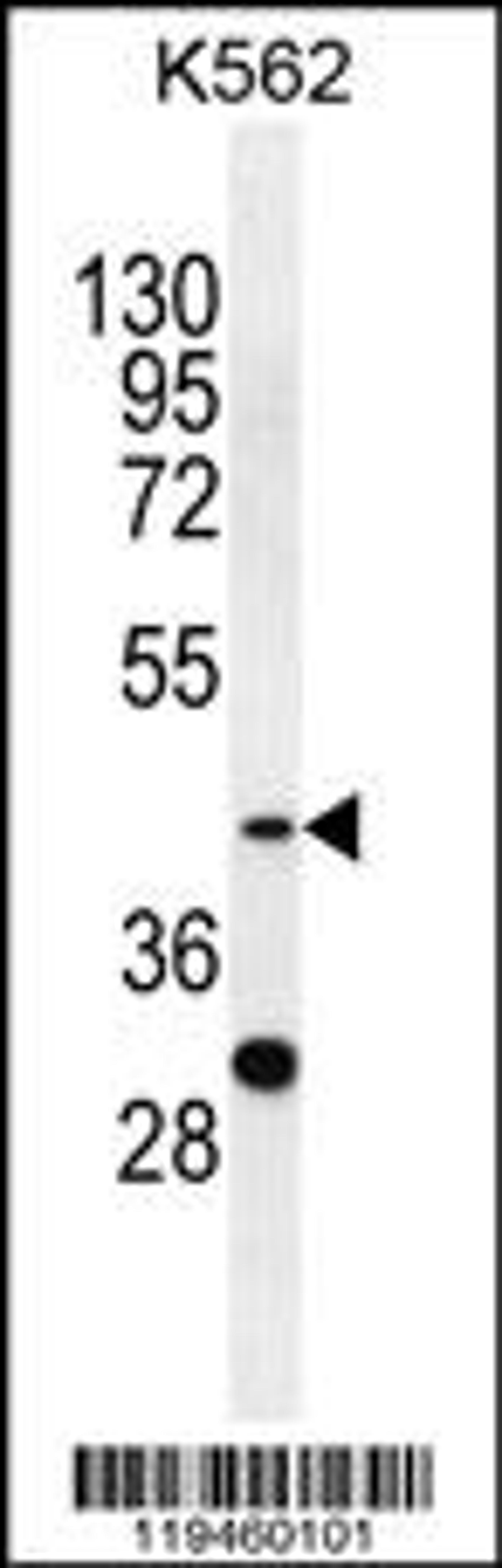 Western blot analysis in K562 cell line lysates (35ug/lane).