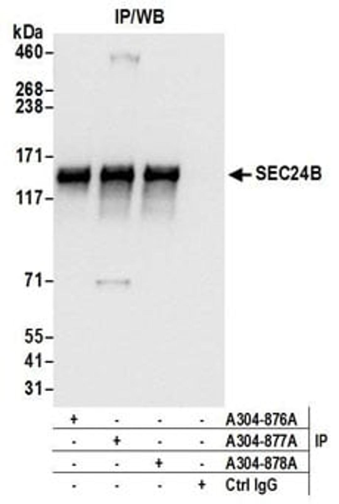 Detection of human SEC24B by western blot of immunoprecipitates.