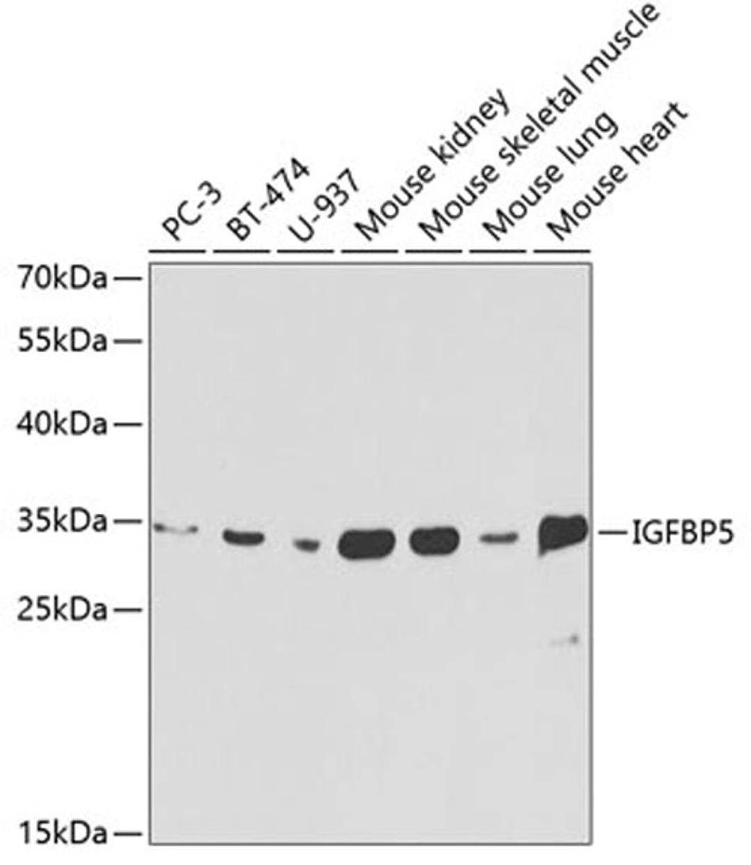 Western blot - IGFBP5 antibody (A1720)