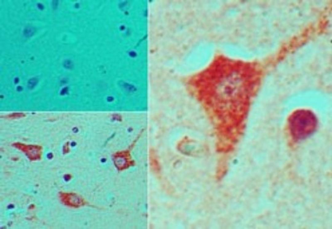 Immunohistochemistry-Paraffin: Nkx2.5 Antibody [NBP2-24675] - Analysis of NKX2-5 in formalin-fixed, paraffin-embedded human brain tissue using an isotype control (top left) and NBP2-24675 (bottom left, right) at 5 ug/ml.