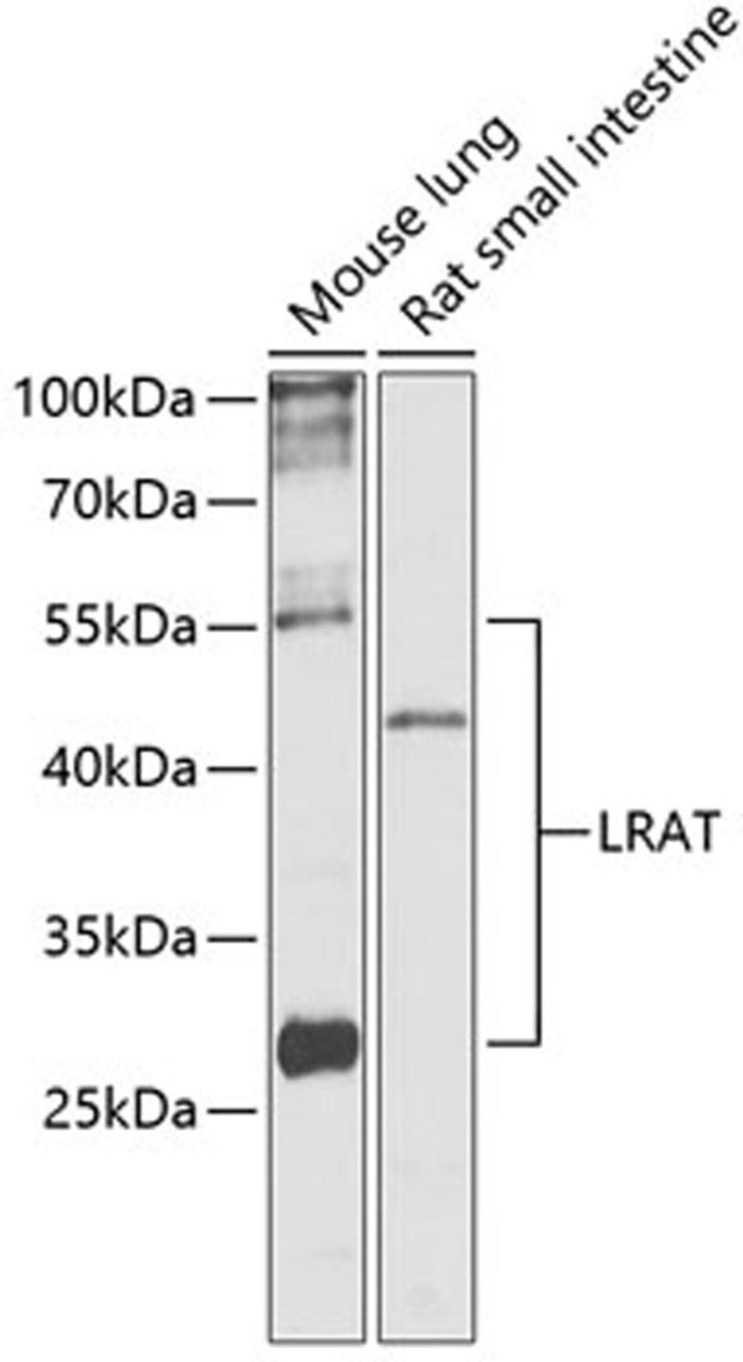 Western blot - Lrat antibody (A13256)