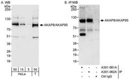 Detection of human AKAP8/AKAP95 by western blot and immunoprecipitation.