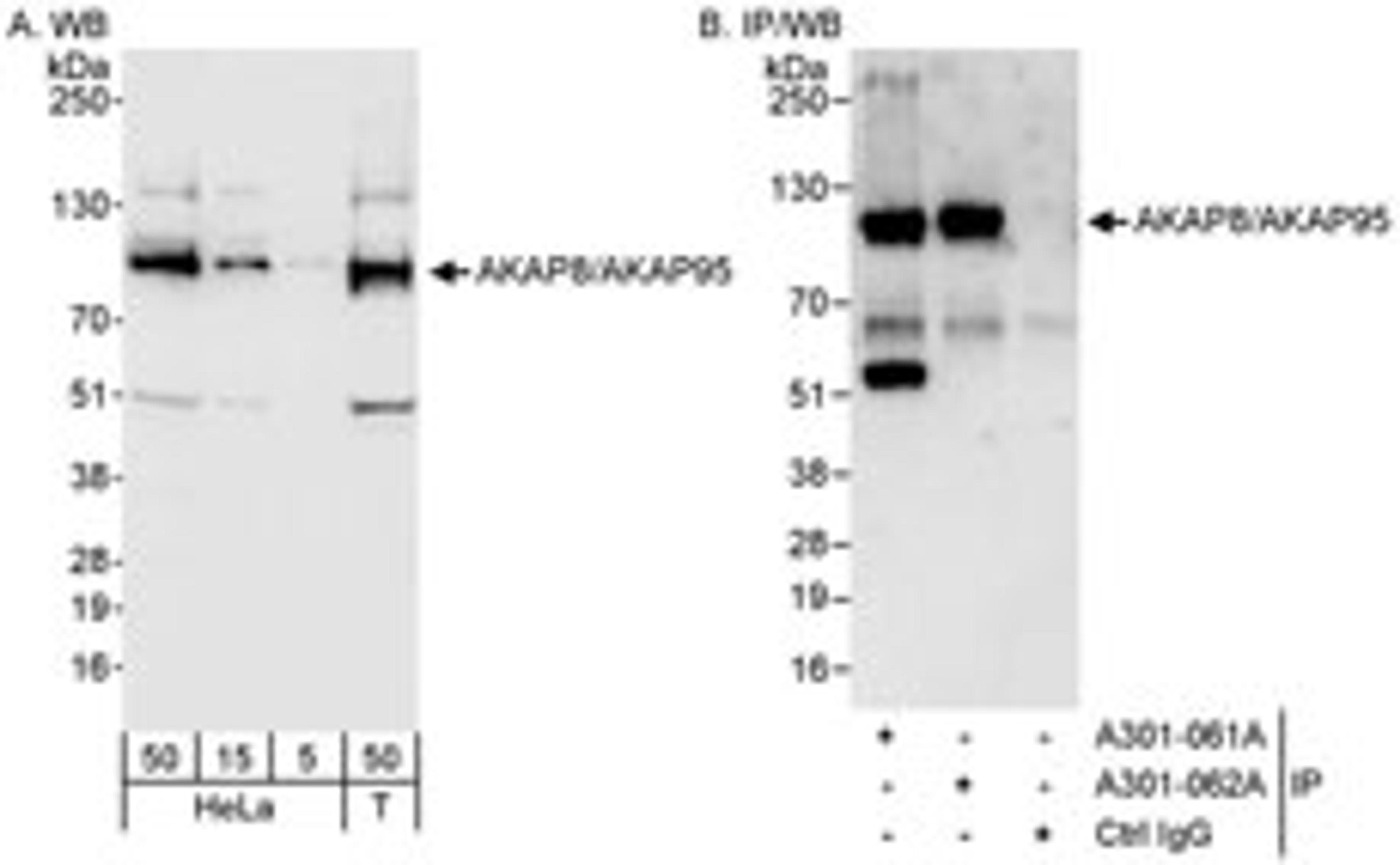 Detection of human AKAP8/AKAP95 by western blot and immunoprecipitation.