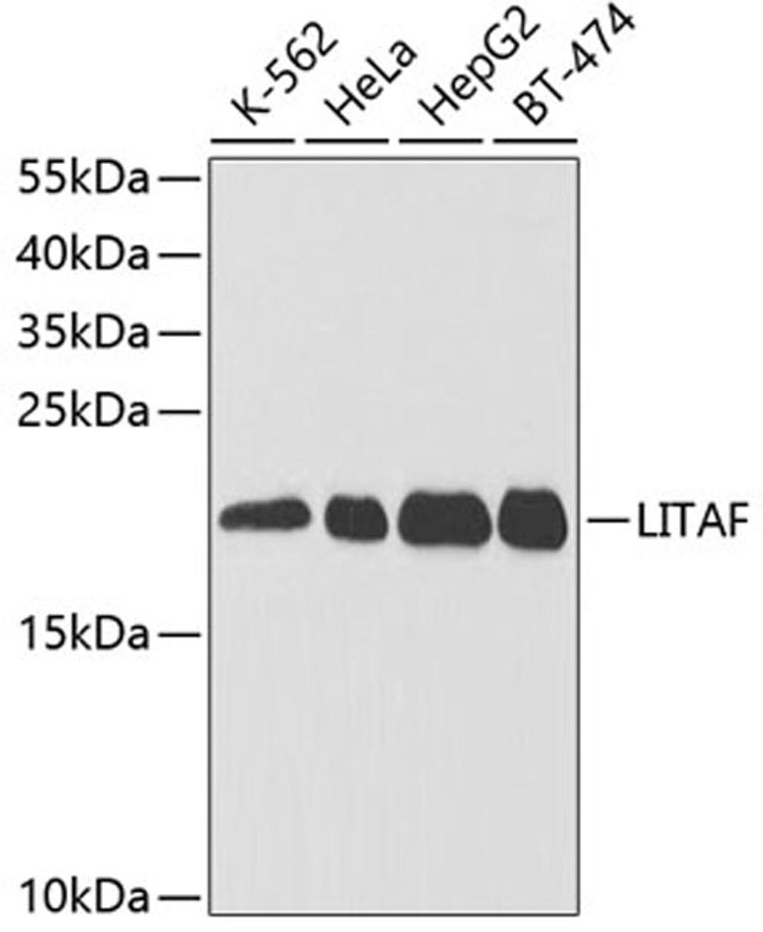 Western blot - LITAF antibody (A5469)