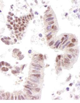 Detection of human CoAA by immunohistochemistry.