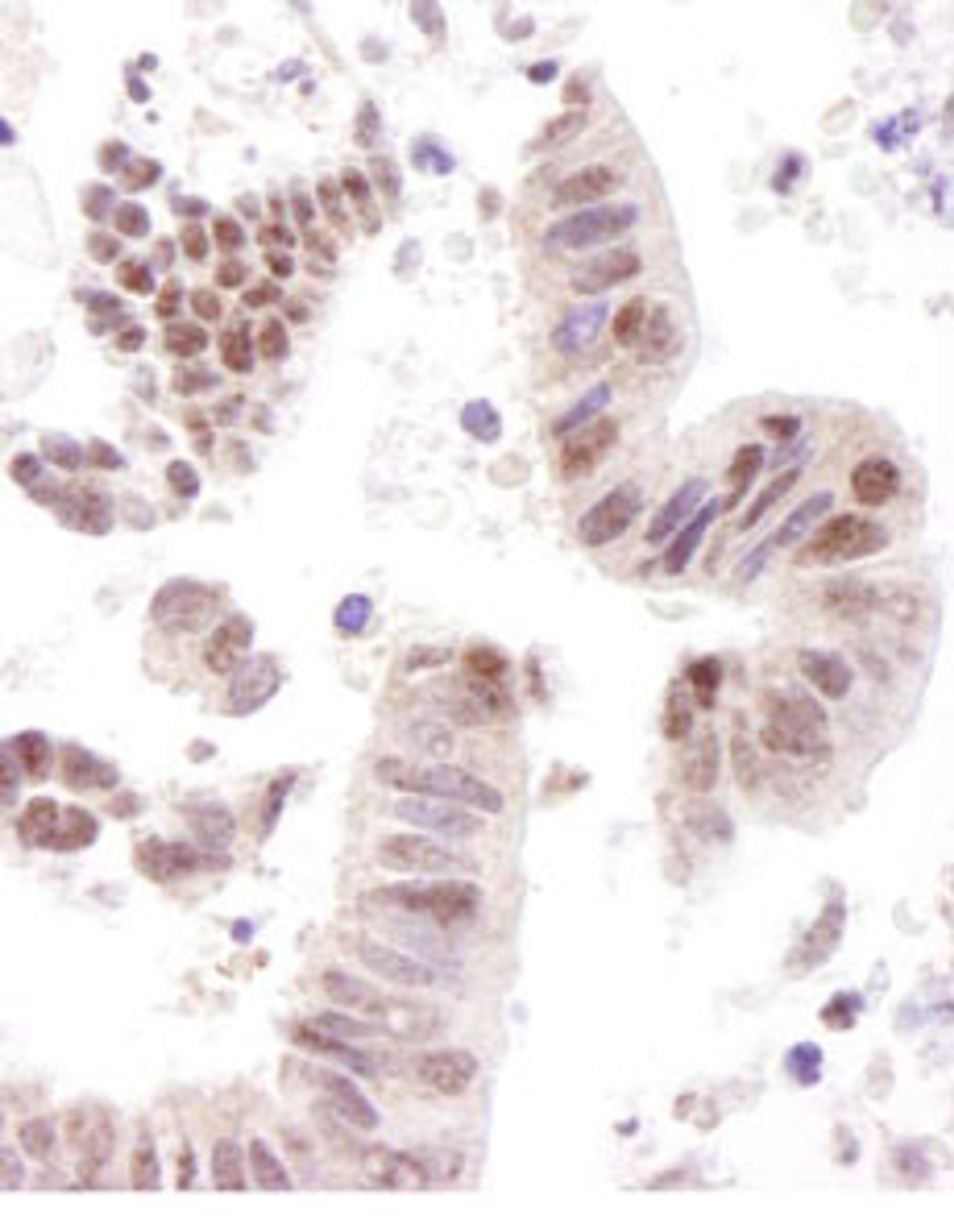 Detection of human CoAA by immunohistochemistry.