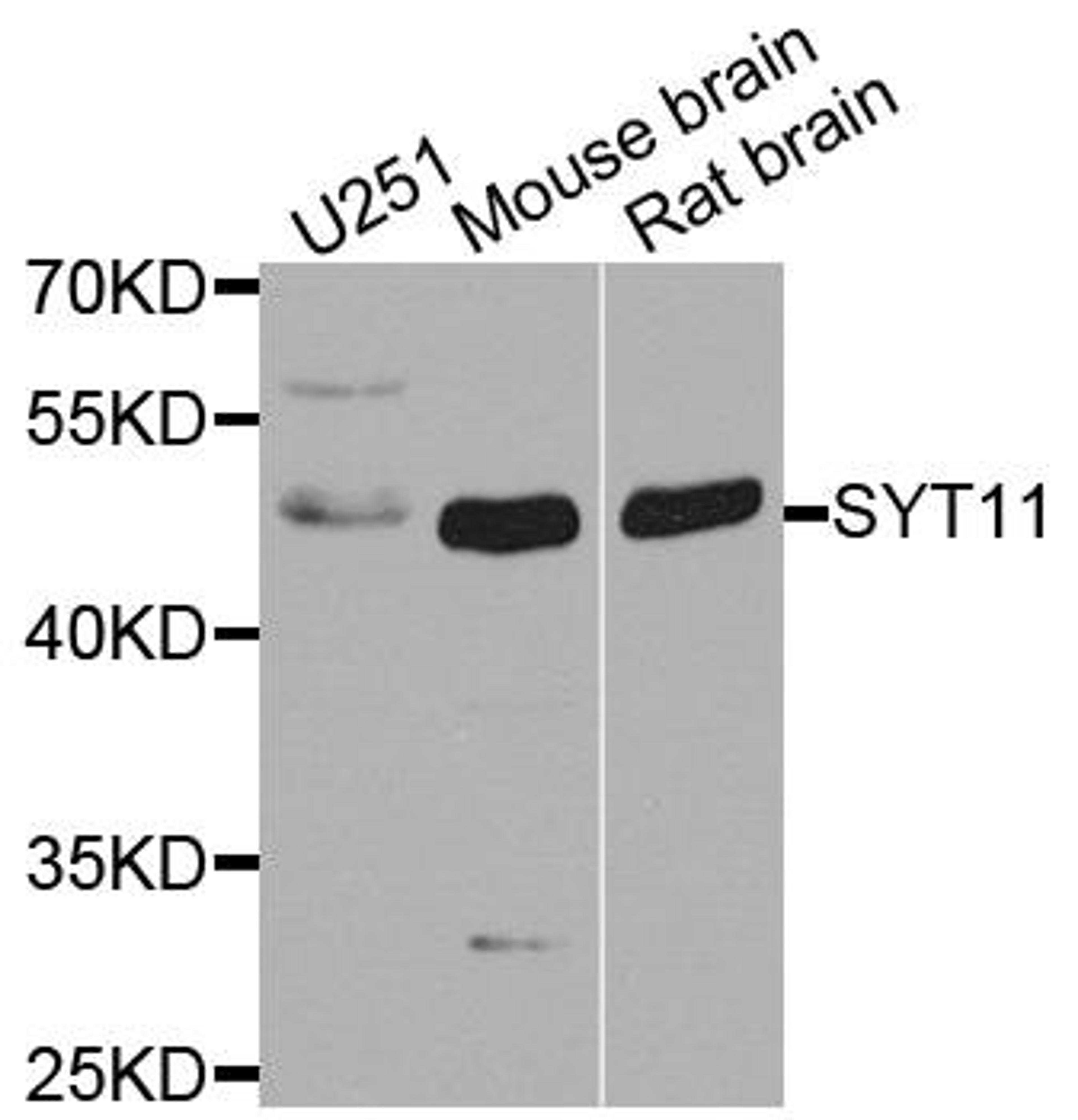 Western blot analysis of extract of various cells using SYT11 antibody