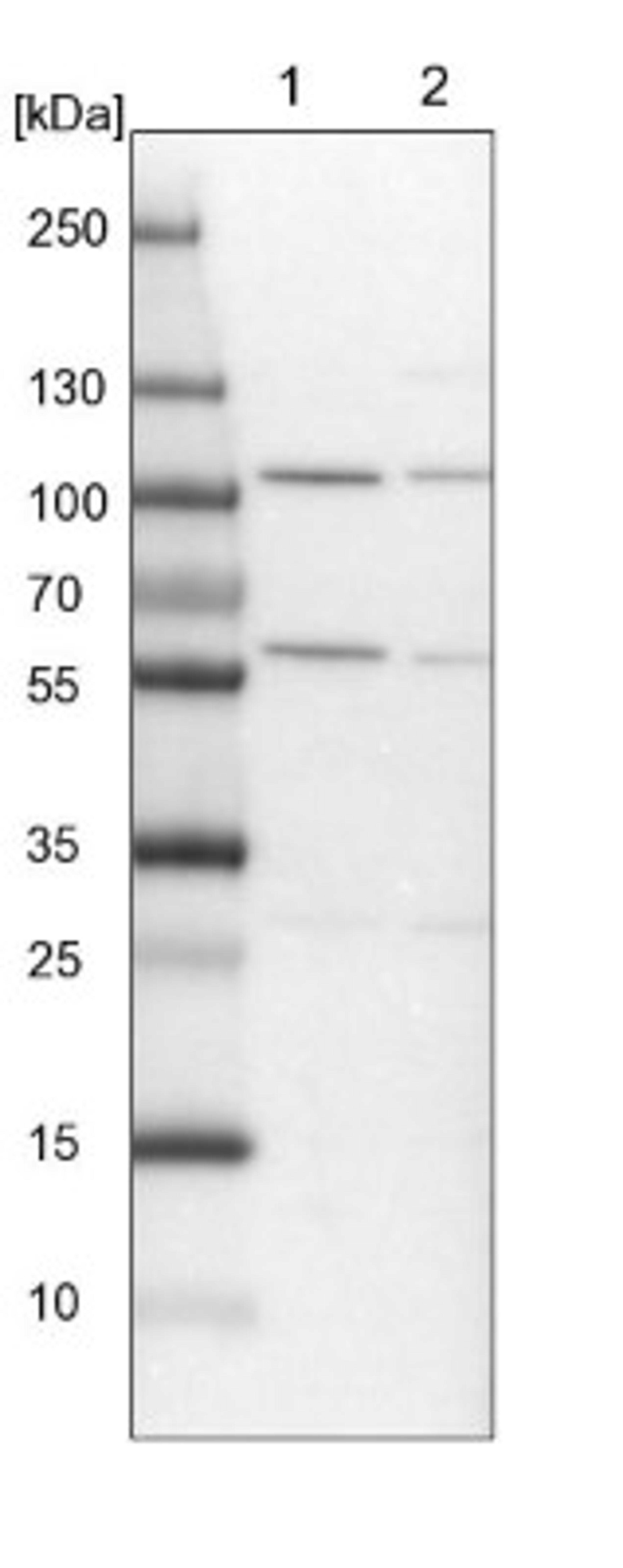 Western Blot: ADHFE1 Antibody [NBP1-83530] - Lane 1: NIH-3T3 cell lysate (Mouse embryonic fibroblast cells)<br/>Lane 2: NBT-II cell lysate (Rat Wistar bladder tumour cells)