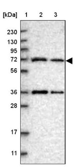 Western Blot: ENTHD1 Antibody [NBP1-93911] - Lane 1: Marker [kDa] 230, 130, 95, 72, 56, 36, 28, 17, 11<br/>Lane 2: Human cell line RT-4<br/>Lane 3: Human cell line U-251MG sp