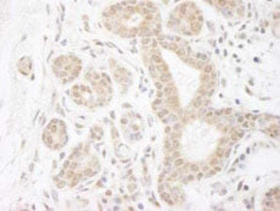 Detection of human DDX20 by immunohistochemistry.