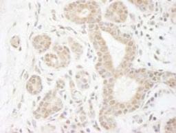 Detection of human DDX20 by immunohistochemistry.