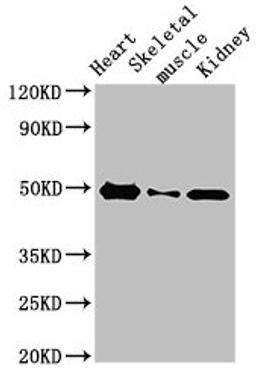 Western Blot. Positive WB detected in: Rat heart tissue, Rat skeletal muscle, Mouse kidney tissue. All lanes: ATP6V1C2 antibody at 3.4ug/ml. Secondary. Goat polyclonal to rabbit IgG at 1/50000 dilution. Predicted band size: 49, 44 kDa. Observed band size: 49 kDa. 