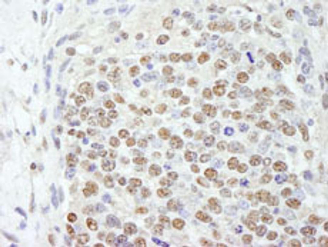 Detection of mouse SF3b145/SAP145 by immunohistochemistry.