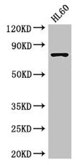 Western Blot. Positive WB detected in: HL60 whole cell lysate. All lanes: RARS antibody at 3.5µg/ml. Secondary. Goat polyclonal to rabbit IgG at 1/50000 dilution. Predicted band size: 76, 68 kDa. Observed band size: 76 kDa
