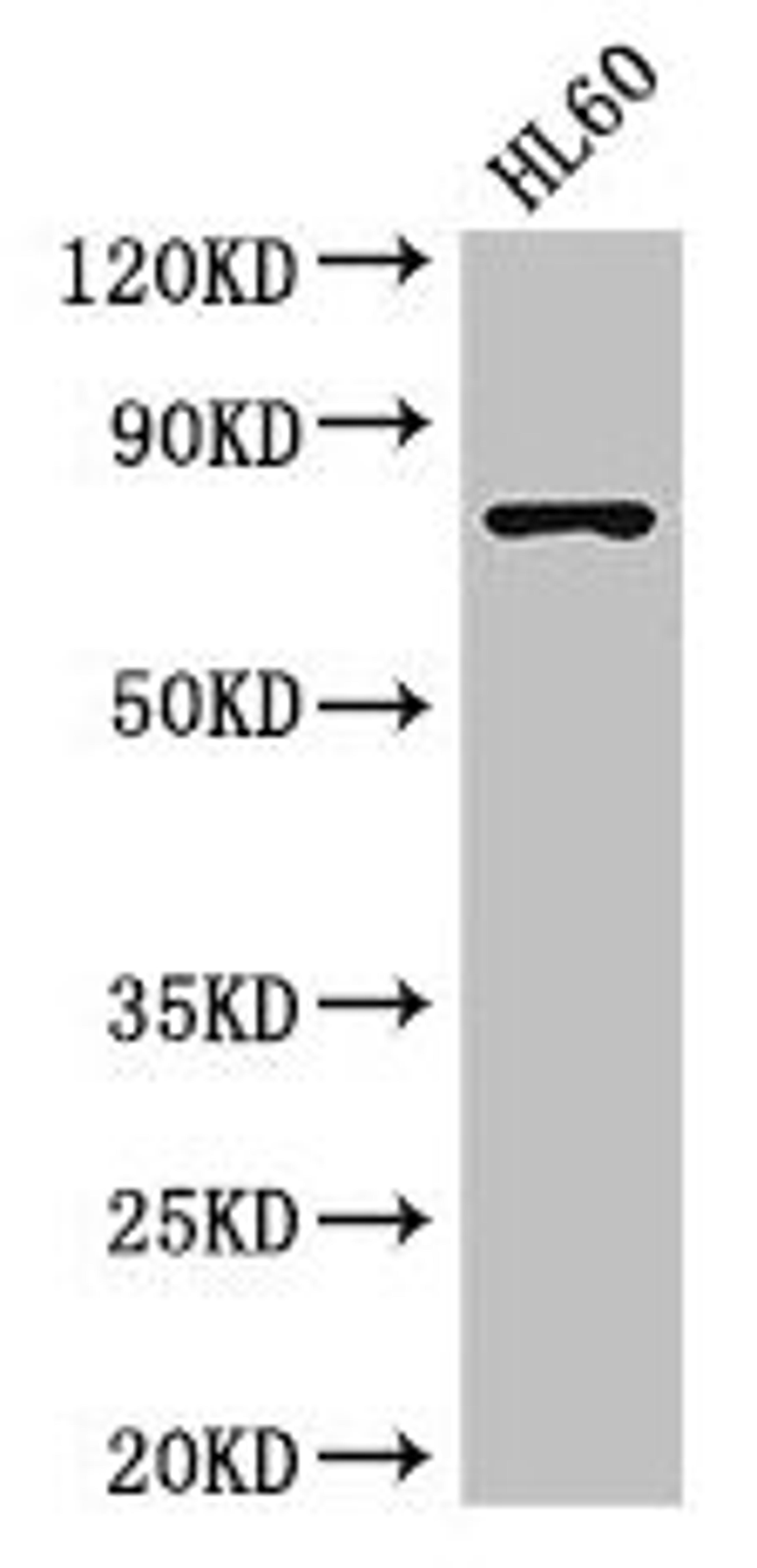 Western Blot. Positive WB detected in: HL60 whole cell lysate. All lanes: RARS antibody at 3.5µg/ml. Secondary. Goat polyclonal to rabbit IgG at 1/50000 dilution. Predicted band size: 76, 68 kDa. Observed band size: 76 kDa
