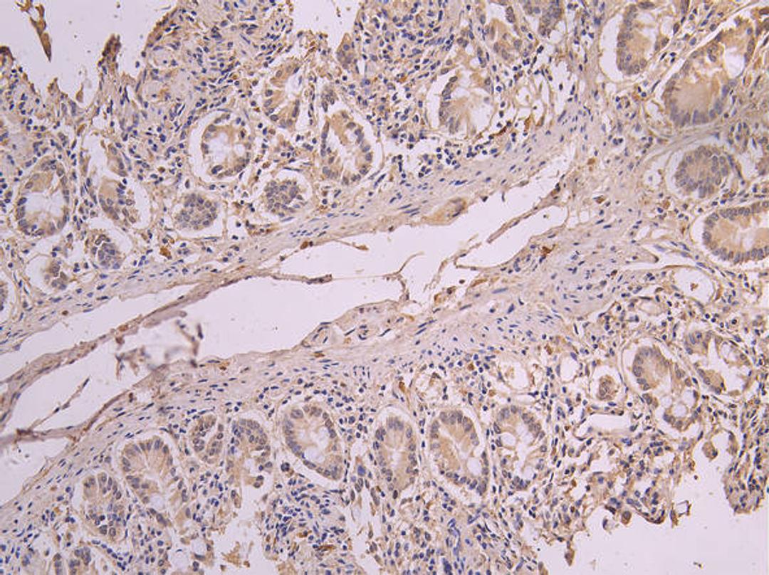 IHC image of CSB-RA007759MA1HU diluted at 1:200 and staining in paraffin-embedded human small intestine tissue performed on a Leica BondTM system. After dewaxing and hydration, antigen retrieval was mediated by high pressure in a citrate buffer (pH 6.0). Section was blocked with 10% normal goat serum 30min at RT. Then primary antibody (1% BSA) was incubated at 4°C overnight. The primary is detected by a Goat anti-human polymer IgG labeled by HRP and visualized using 0.05% DAB.