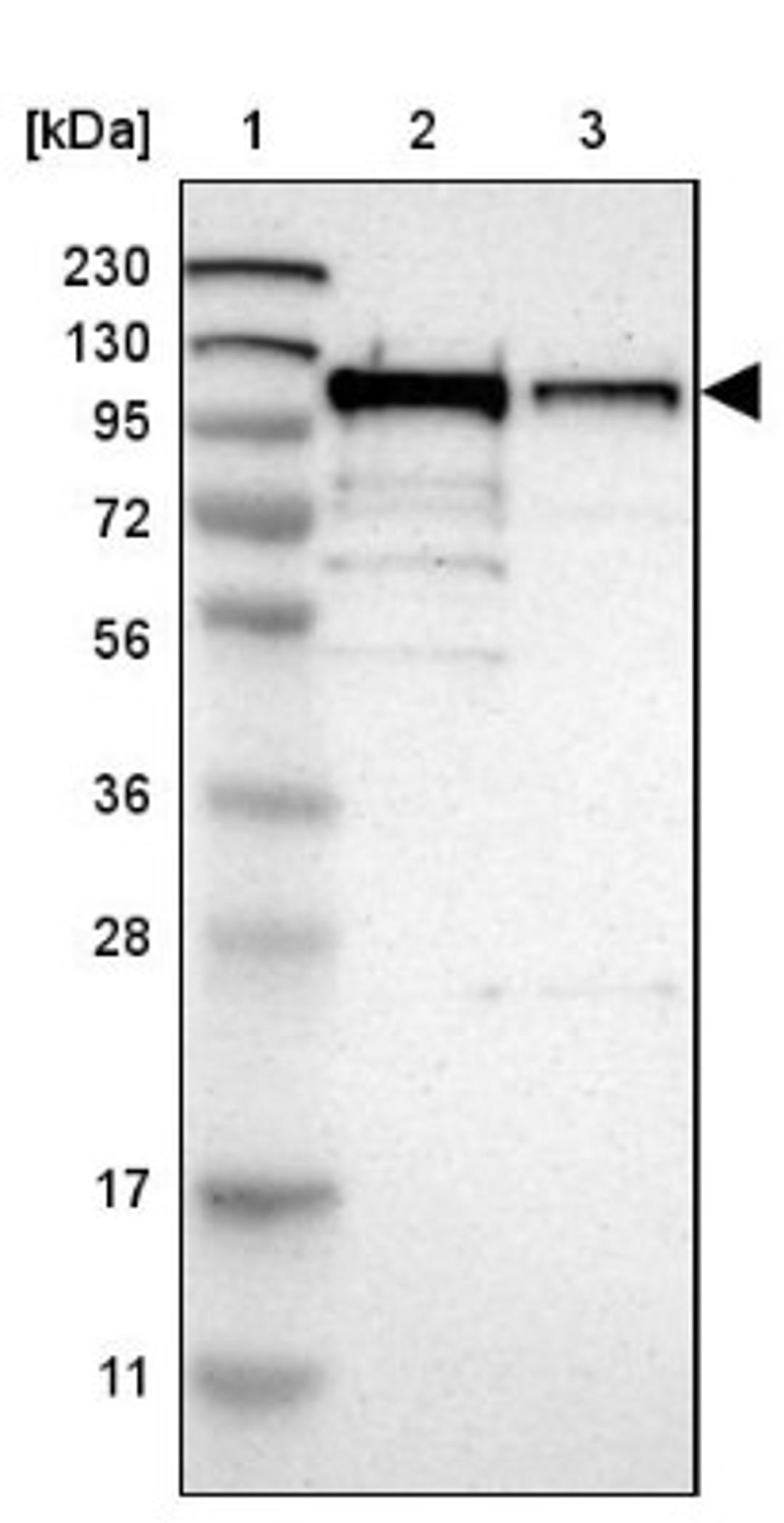 Western Blot: SCYL1 Antibody [NBP1-83365] - Lane 1: Marker [kDa] 230, 130, 95, 72, 56, 36, 28, 17, 11<br/>Lane 2: Human cell line RT-4<br/>Lane 3: Human cell line U-251MG sp