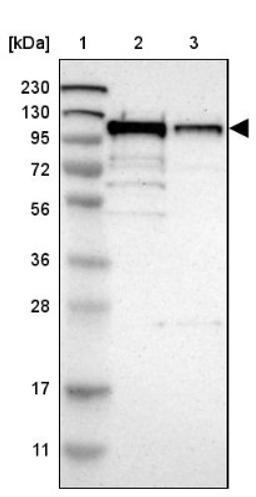 Western Blot: SCYL1 Antibody [NBP1-83365] - Lane 1: Marker [kDa] 230, 130, 95, 72, 56, 36, 28, 17, 11<br/>Lane 2: Human cell line RT-4<br/>Lane 3: Human cell line U-251MG sp