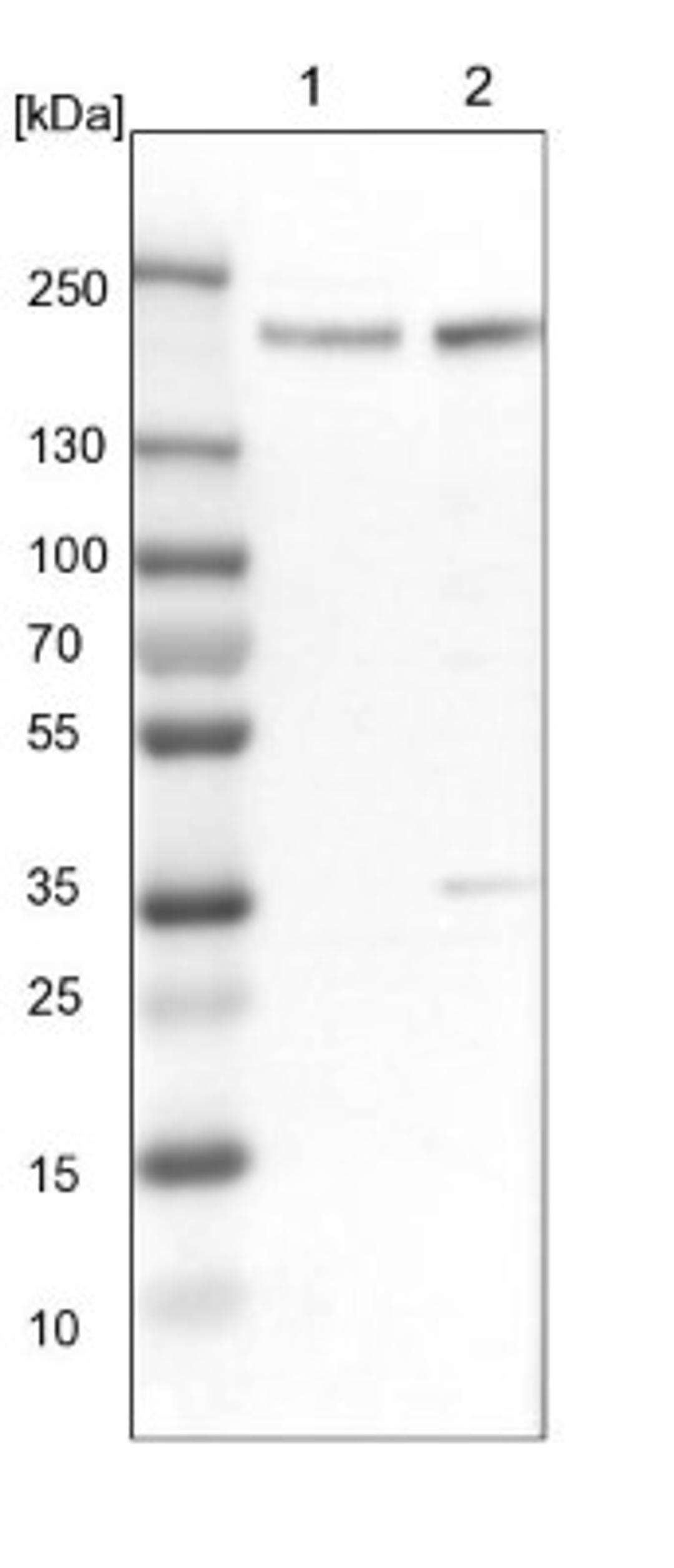 Western Blot: PRKCBP1 Antibody [NBP1-87227] - Lane 1: NIH-3T3 cell lysate (Mouse embryonic fibroblast cells)<br/>Lane 2: NBT-II cell lysate (Rat Wistar bladder tumour cells)