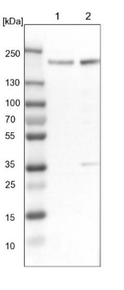 Western Blot: PRKCBP1 Antibody [NBP1-87227] - Lane 1: NIH-3T3 cell lysate (Mouse embryonic fibroblast cells)<br/>Lane 2: NBT-II cell lysate (Rat Wistar bladder tumour cells)