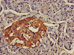 Immunohistochemistry of paraffin-embedded human pancreatic tissue using CSB-PA848414LA01HU at dilution of 1:100