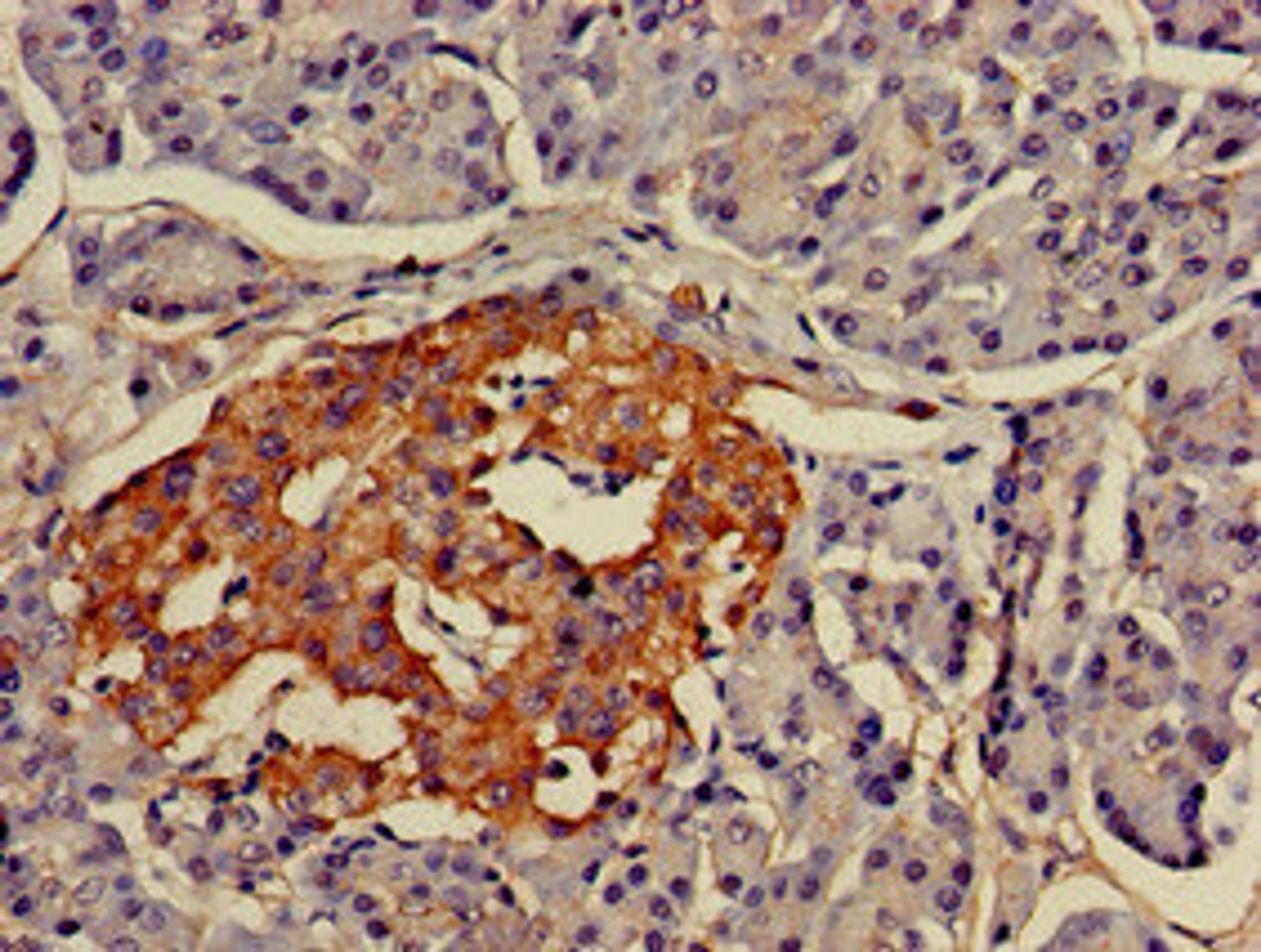 Immunohistochemistry of paraffin-embedded human pancreatic tissue using CSB-PA848414LA01HU at dilution of 1:100
