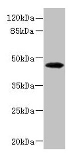 Western blot. All lanes: PHKG2 antibody at 3.4µg/ml + HepG2 whole cell lysate. Secondary. Goat polyclonal to rabbit IgG at 1/10000 dilution. Predicted band size: 47, 44 kDa. Observed band size: 47 kDa