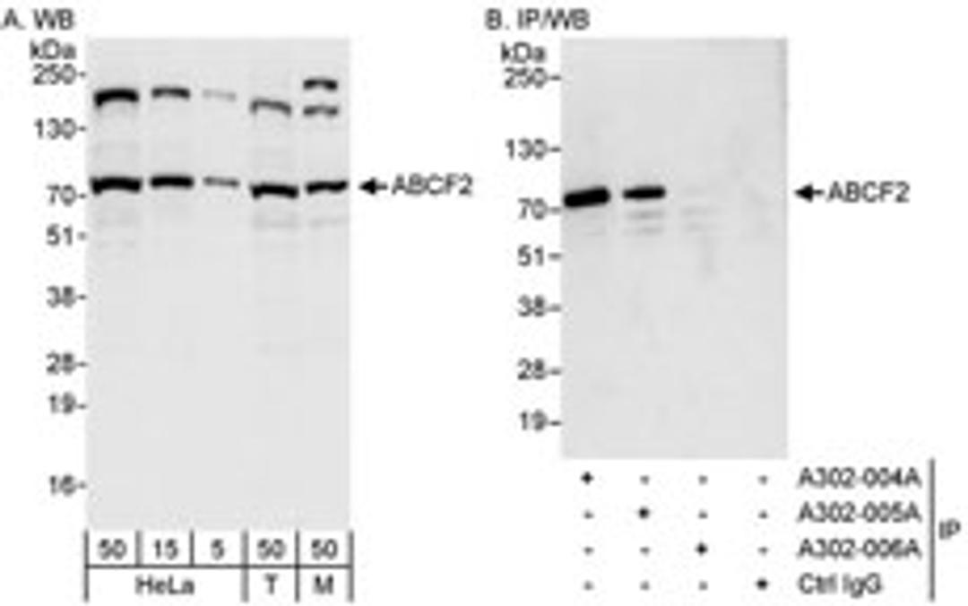 Detection of human and mouse ABCF2 by western blot (h&m) and immunoprecipitation (h).