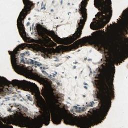 Immunohistochemistry-Paraffin: GDF-15 Antibody [NBP1-81050] - Staining of human placenta shows strong cytoplasmic positivity in trophoblastic cells.