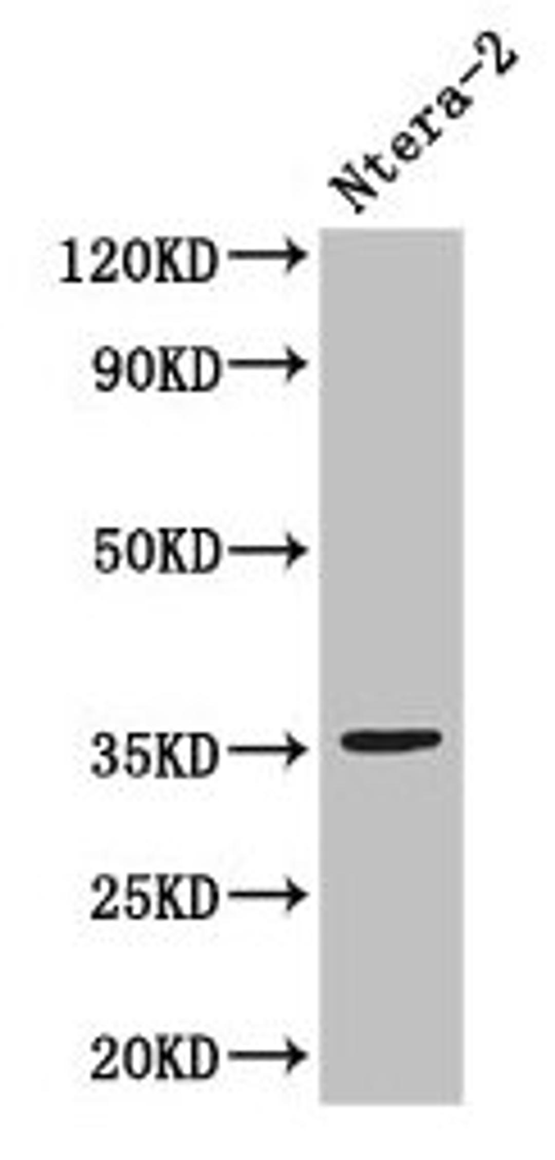 Western Blot. Positive WB detected in: Ntera-2 whole cell lysate. All lanes: NANOG antibody at 3µg/ml. Secondary. Goat polyclonal to rabbit IgG at 1/50000 dilution. Predicted band size: 35, 33 kDa. Observed band size: 35 kDa