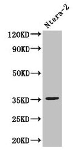Western Blot. Positive WB detected in: Ntera-2 whole cell lysate. All lanes: NANOG antibody at 3µg/ml. Secondary. Goat polyclonal to rabbit IgG at 1/50000 dilution. Predicted band size: 35, 33 kDa. Observed band size: 35 kDa